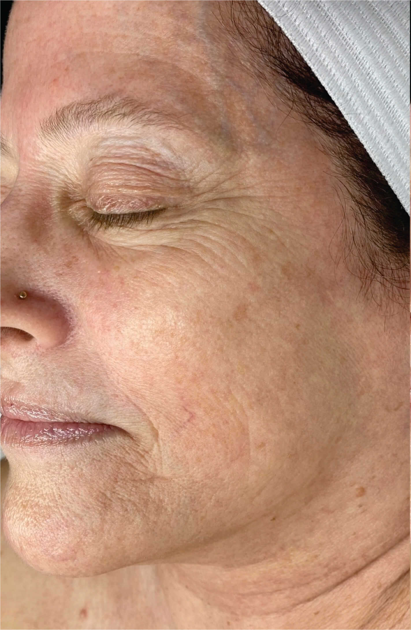 face1