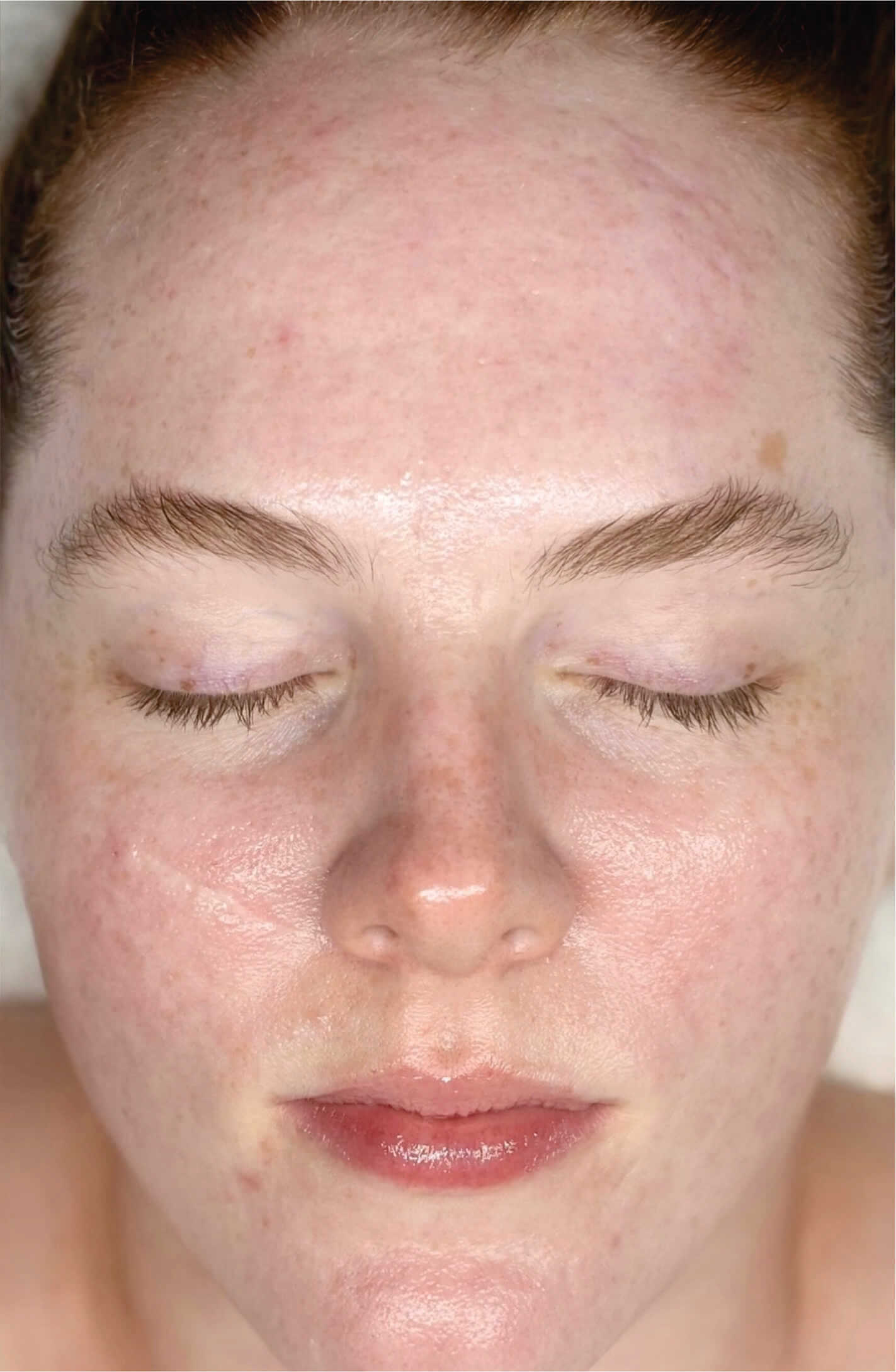 face1